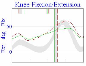 Lack of knee extension terminal swing