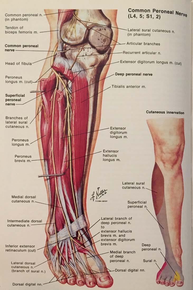 Anterior Lateral Leg Common Peroneal wraps around Fibular Neck Divides into: Superficial Peroneal Nerve - Lateral Compartment of