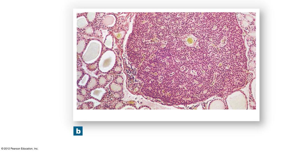Figure 18-12b The Parathyroid Glands Blood vessel Connective tissue capsule of