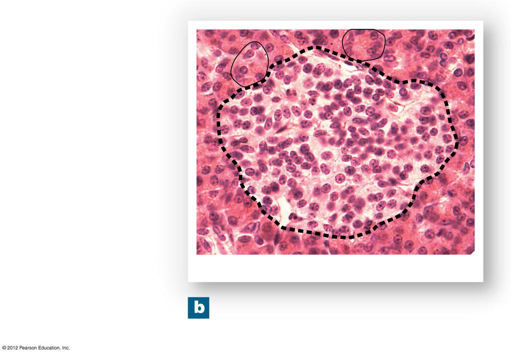 Figure 18-16b The Endocrine Pancreas Pancreatic acini (clusters of exocrine cells) Pancreatic islet