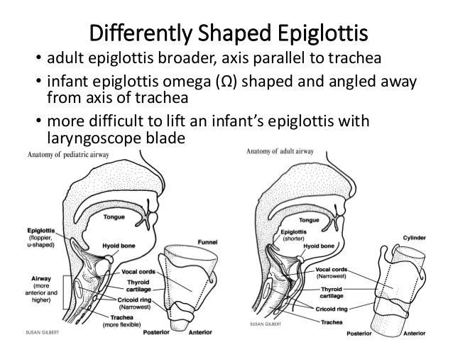 The Epiglottis The epiglottis is larger, lies higher and more vertical than in adults The epiglottis is what shape?