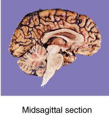 (transverse, frontal, and midsagittal