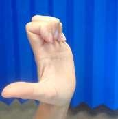 Stage 2 exercises if advised to follow at 6 week clinic: Finger and wrist flexion and extension Open