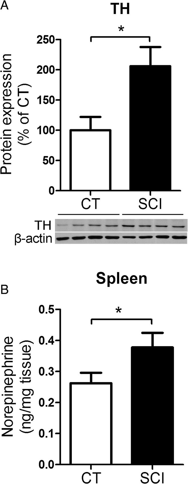 Zha et al. Journal of Neuroinflammation 2014, 11:65 Page 13 of 18 Figure 8 Chronic spinal cord injury (SCI) increases the sympathetic activity in the spleen.