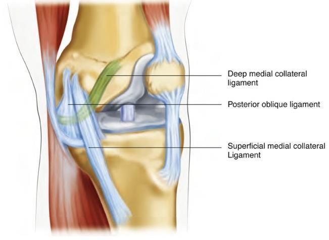 the PCL, to prevent the tibia from sliding posteriorly from under the femur (posterior dislocation) 81.