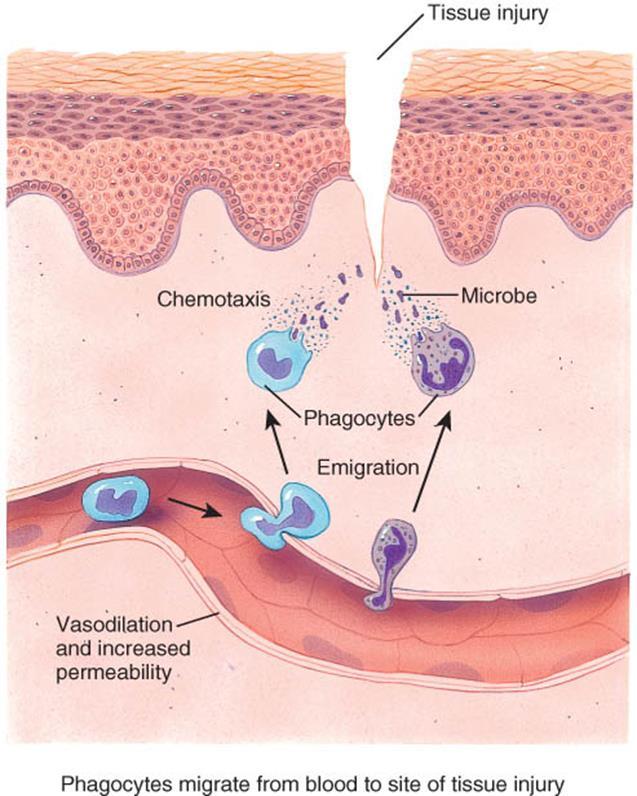 Stages of Inflammation o Three basic stages of inflammation: 1. Vasodilation and increased permeability of blood vessels, 2.