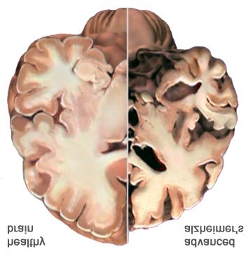 1 All of the following protect the brain EXCEPT 2 Which of the following is the correct order of meninges from outside to inside?