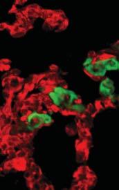 Lung setions from vehile-treted, drug-omintion-treted nd off-drug mie were proessed for immunofluoresent detetion of tumour-speifi vimentin (green) nd CD31 (red). Sle rs, mm.