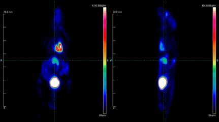 Tumor size monitored in vivo via FDG-PET TLR7