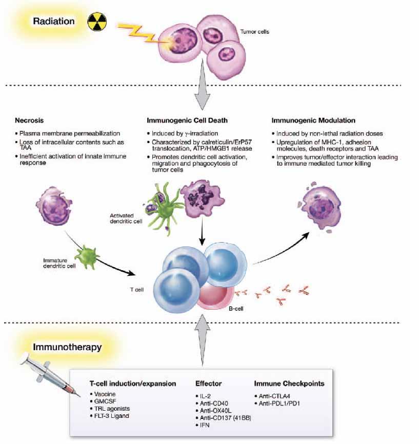 Radiation and Immune Therapy Combination
