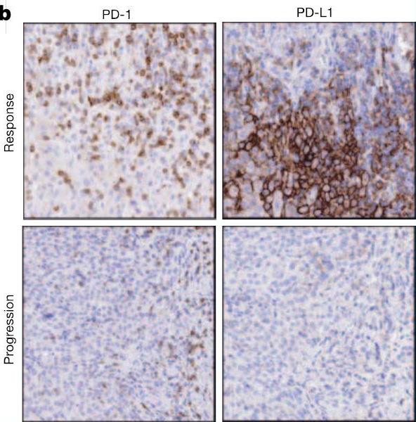Response to anti-pd1 is associated with baseline T