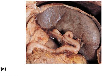 Figure 20.6c The spleen.