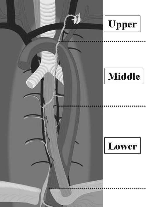 M Kiyonaga, H Mori, S Matsumoto et al Figure 1. Schematic drawing of the three sections of the thoracic duct. The thoracic duct was divided into three anatomical sections.