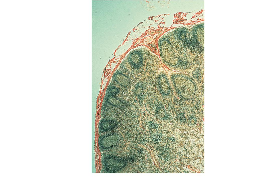 Microscopic Anatomy of a Lymph Node Microscopic Anatomy of a Lymph Node Follicles Trabecula Subcapsular sinus Macrophage Reticular cells on reticular fibers Lymphocytes Capsule Medullary sinus