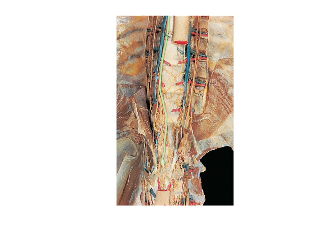lumbar trunk Inferior vena cava Intestinal trunk (a) Major lymphatic trunks and ducts in relation to veins and surrounding structures, anterior view Figure 21.