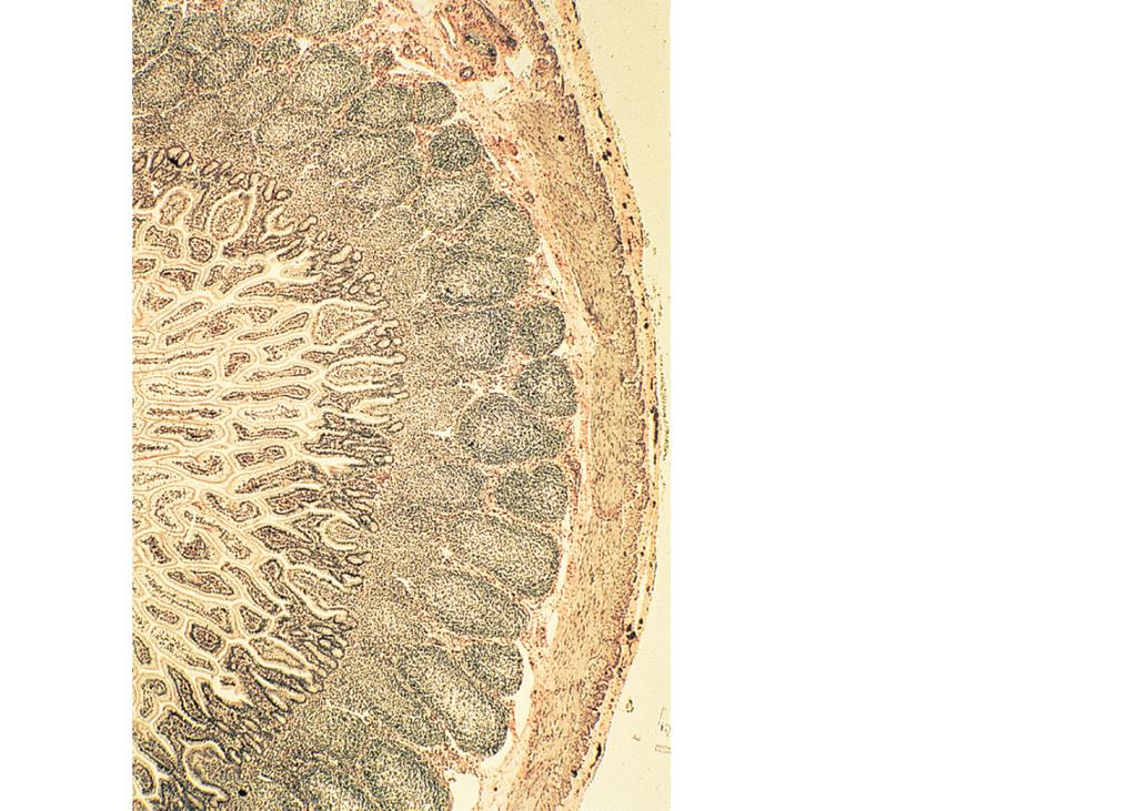 lymphoid tissue) Tonsillar crypt Aggregated Lymphoid Nodules and Appendix Germinal centers in lymphoid follicles 11