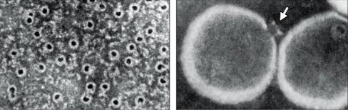 C3b is an opsinizing molecule coats microbes to enhance phagocytosis SequenBal cleavage of complement proteins by proteases produces