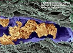 Dendritic cells Macrophages