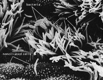 How do bacteria cause disease?
