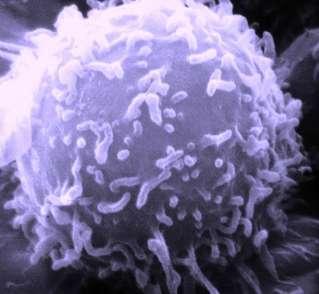B- Natural killer (NK) Definition: Large granular lymphocytes Innate cytotoxic lymphocytes Source :