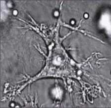 Dendritic cell -