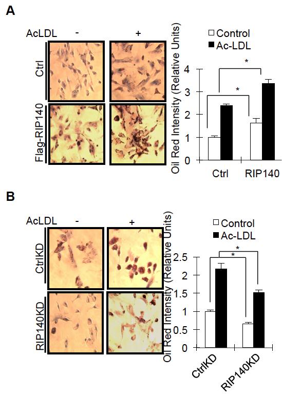 Fig. S2-1 RIP140 enhances acetylated LDL-promoted cholesterol accumulation in macrophages.