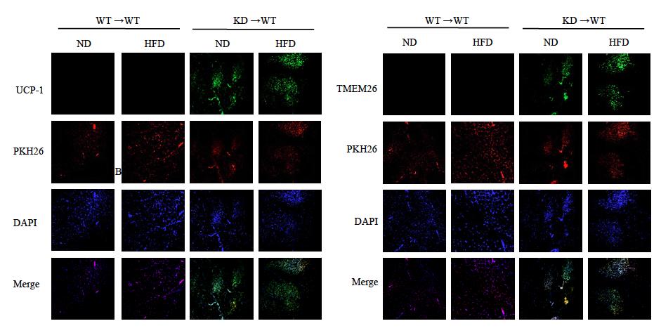 Fig. S3-4 Induction of browning phenotype in RIP140 KD produced using BMT. WT WT and KD WT mice were fed a ND or a HFD for 15 weeks.