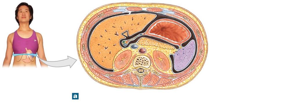 Figure 14-8a The Spleen.