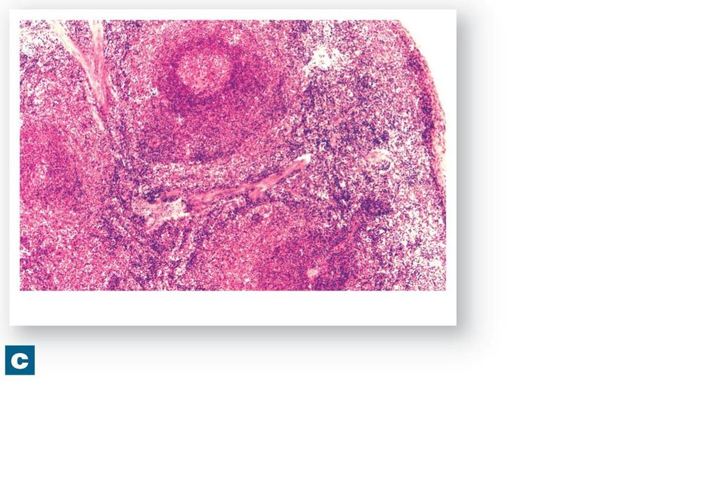 Figure 14-8c The Spleen. White pulp of splenic nodule Capsule Red pulp Arteries The spleen LM x 50 The histological appearance of the spleen.