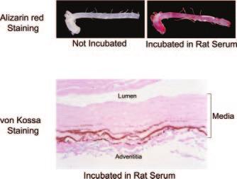 1080 Arterioscler Thromb Vasc Biol. May 2006 Downloaded from http://atvb.ahajournals.org/ by guest on April 21, 2018 induces calcification in the elastic lamellae of the artery media.