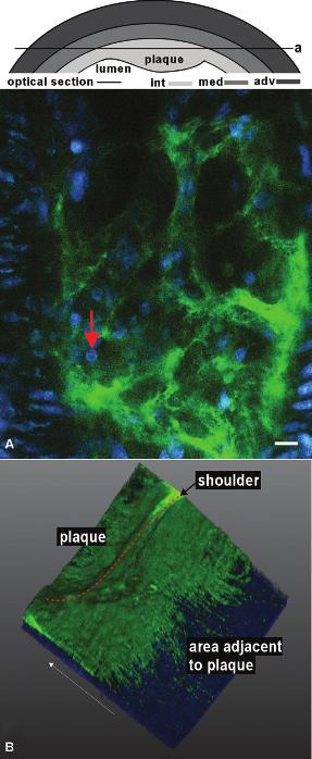 Molecular Imaging of Collagen in (Diseased) Arteries 255 reconstruction of the shoulder area of an atherosclerotic plaque stained with CNA35/OG488).