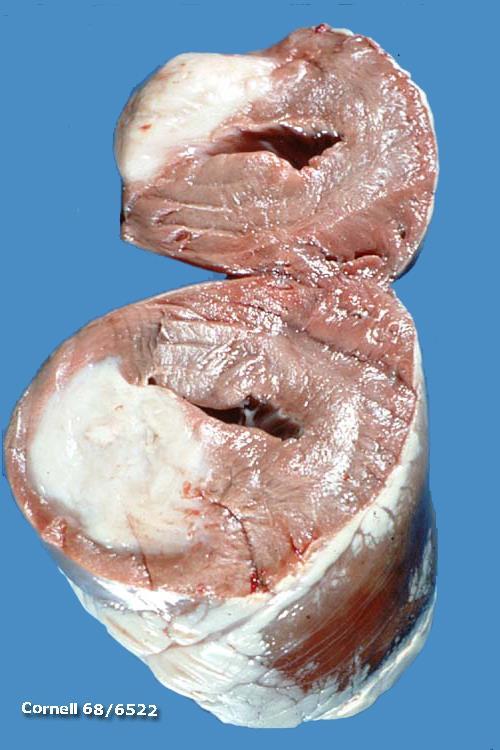 TUMOURS OF THE CARDIOVASCULAR SYSTEM Rhabdomyoma Benign tumour of skeletal muscle Rhabdomyosarcoma Malignant tumour of skeletal muscle Cardiac rhabdomyoma has