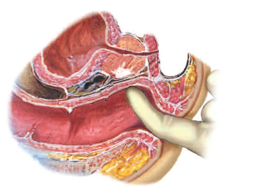 The urethra passes through the prostate gland, which is broader at its base than apex.