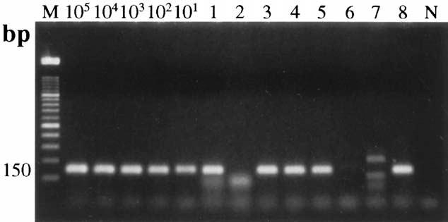LightCycler-polymerase chain reaction (LC-PCR) and the amplified products were electrophoresed. The estimated size of the amplified product was 150 bp in length.