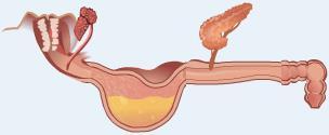 Teeth and muscular contractions in the stomach break food down into smaller particles, a process called mechanical digestion.