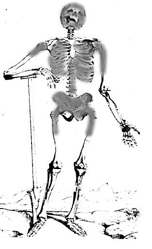 Which Bones Are Affected? Why bone?