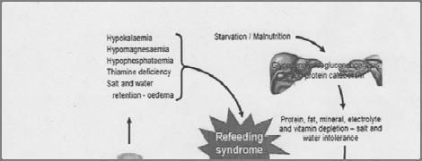 The refeeding syndrome was first reported among those