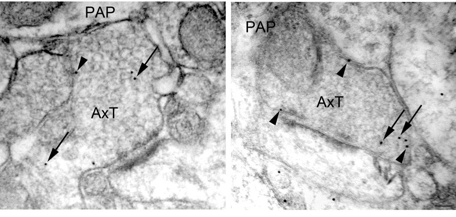 Ceftriaxone treatment of heterozygous FHM2 KI mice increases the density of GLT-1a in the membrane of cortical axon terminals FHM2 KI Ctr KI Cef KI