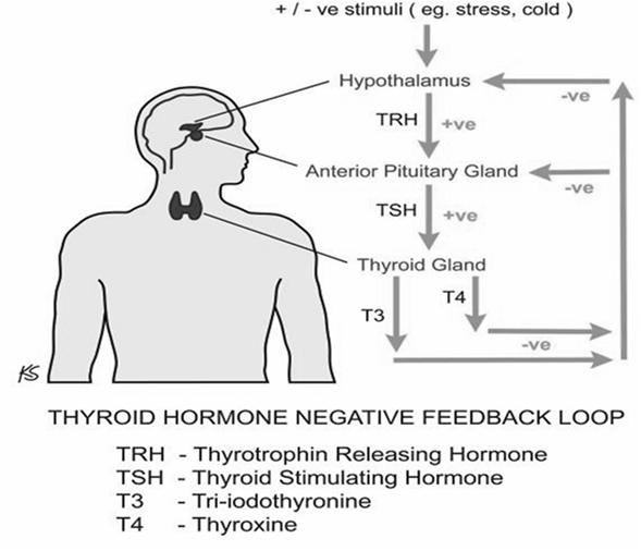 Hyperthyroidism: Antithyroid Agents Hyperthyroidism (thyrotoxicosis) Breakdown in feedback loop Excessive levels of thyroid hormones Most common cause = Graves disease (autoimmune) Severe = thyroid