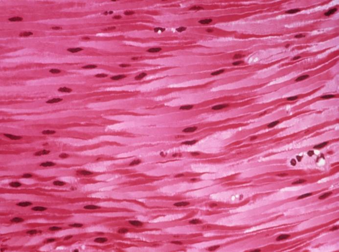 SMOOTH MUSCLE Also known as visceral muscle Small Spindle shaped Non-striated Involuntary
