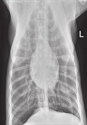 A Figure 3. The surgical field. b C Figure 1. (A) Left lateral chest radiograph showing no signs of metastatic disease. (B) Right lateral chest radiograph showing no signs of metastatic disease.
