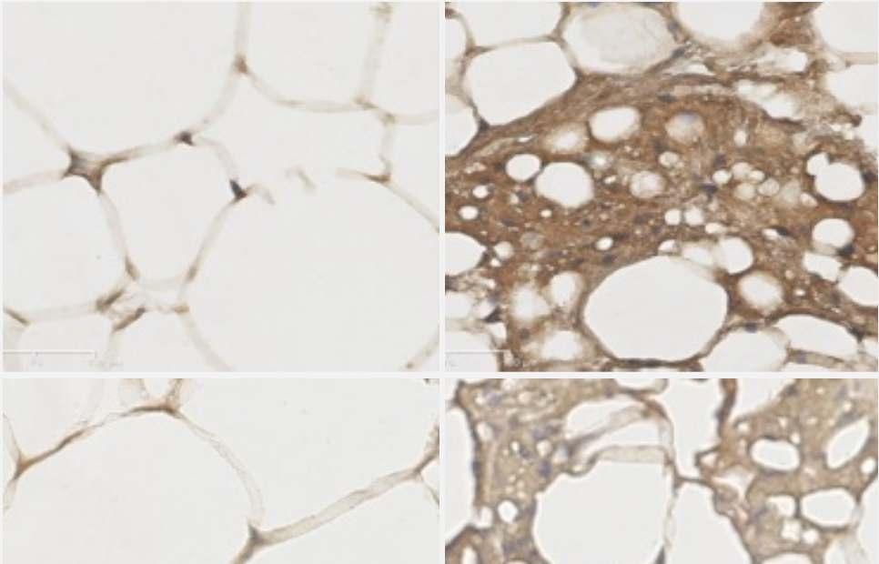 Third Type of Fat: Beige Fat Beige Fat: Stained by an antibody against UCP1, by Ting Fu HFD HFD (+anti-mir-34a) Beige fats are