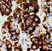 2016 New Antibodies for Immunohistochemistry Adipophilin / ADRP, MMab (BSB-91) Adipophilin is suitable for immunostaining and is helpful in the identification of intracytoplasmic lipids, as seen in