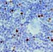 2016 New Antibodies for Immunohistochemistry FOXP3, RMab (EP340) FOXP3 is a protein involved in immune system responses.