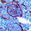 grade hepatocellular carcinoma. Application: Liver Cancer Helicobacter Pylori, RMab (EP279) Helicobacter pylori is a helix-shaped Gram-negative bacterium.