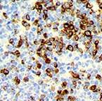 Application: Infectious Diseases, Colon & GI Cancer hgal / GCET2, RMab (EP316) The HGAL protein has been shown to be expressed in the cytoplasm of germinal center B lymphocytes and in B cell