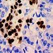 Application: Lymphoma, Hodgkin s & NH Lymphoma HPV16, MMab (CAMVIR-1) All known papillomavirus types infect a particular body surface, typically the skin or mucosal epithelium of the genitals, anus,