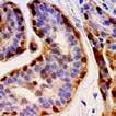 Maspin, MMab (BSB-92) Maspin has been shown in primary breast cancer to be regulated by wild-type p53, defining a new category of molecular targets of p53 that have the potential to negatively