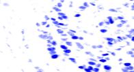 Color deconvolution parameters can vary according to the used dyes in histopathology and the imaging protocols [1].