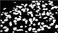 Given the RGB microscopic image, enhance the image contrast through intensity histogram equalization. Step 2.